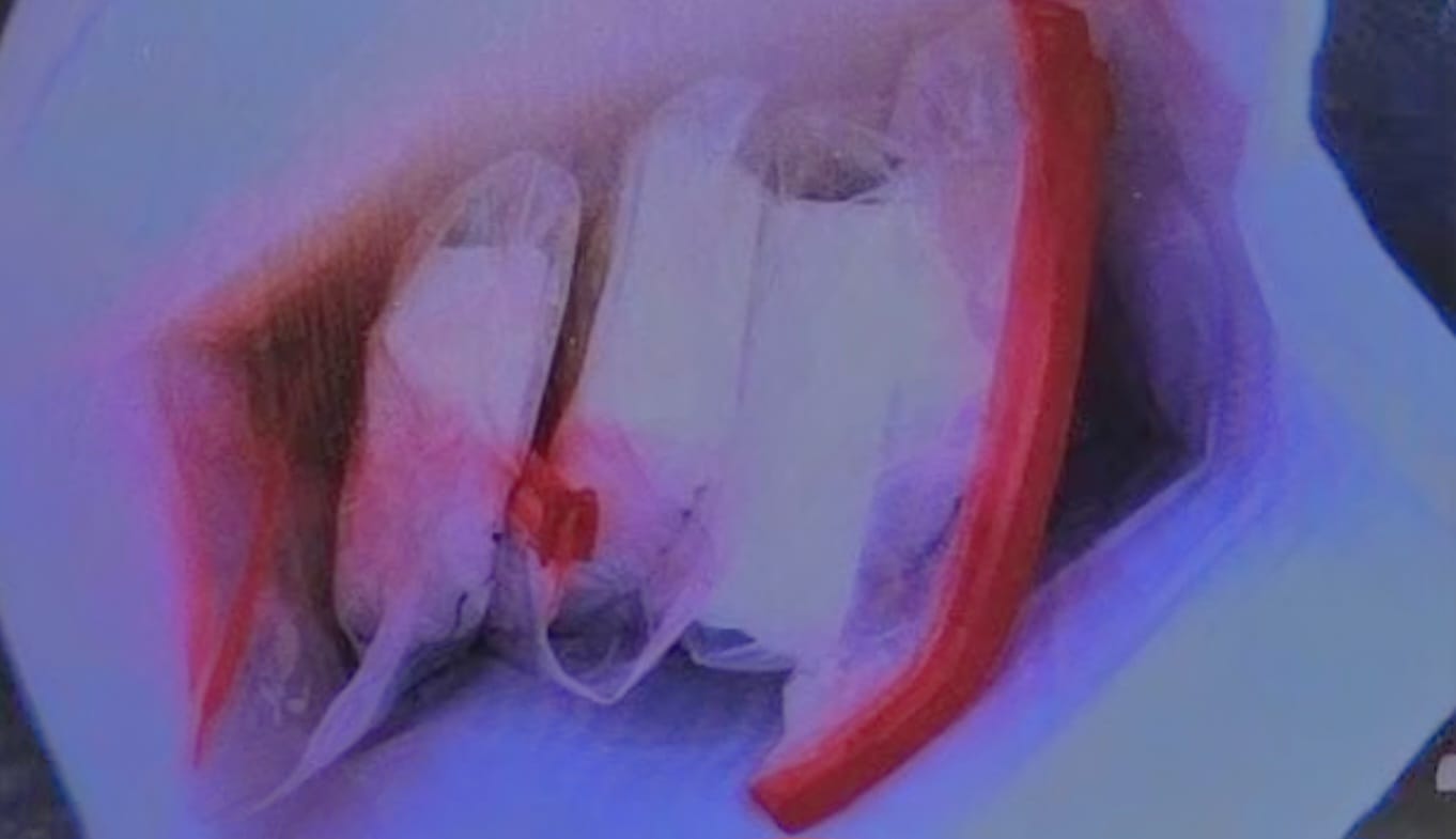 הסמים אשר נתפסו. צילום: דוברות המשטרה